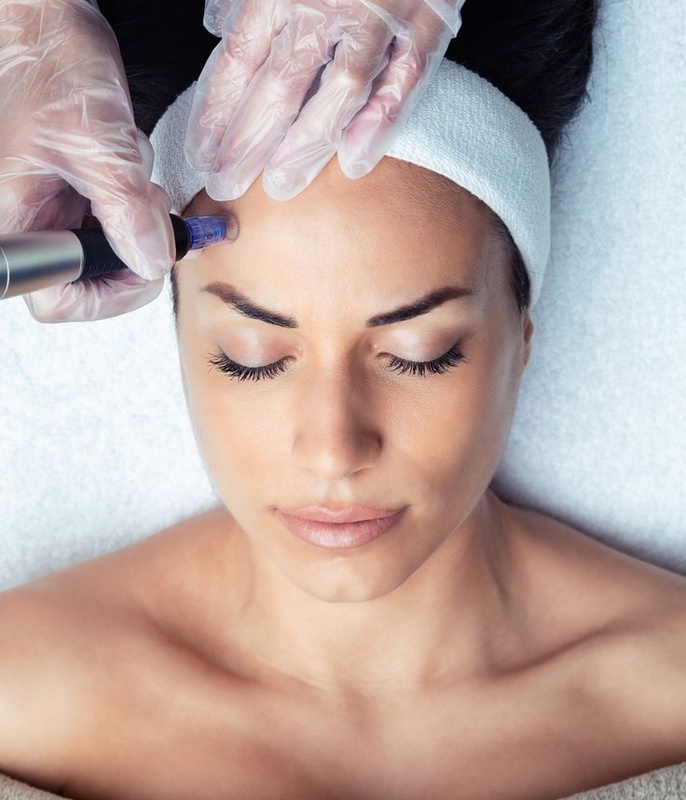All About Microneedling