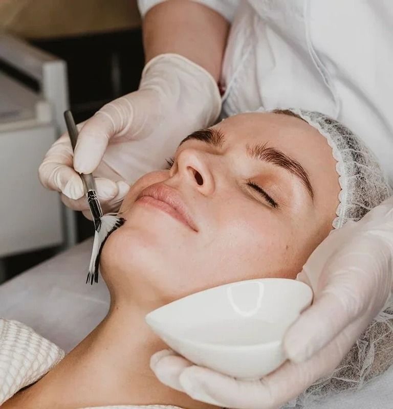 Chemical peel