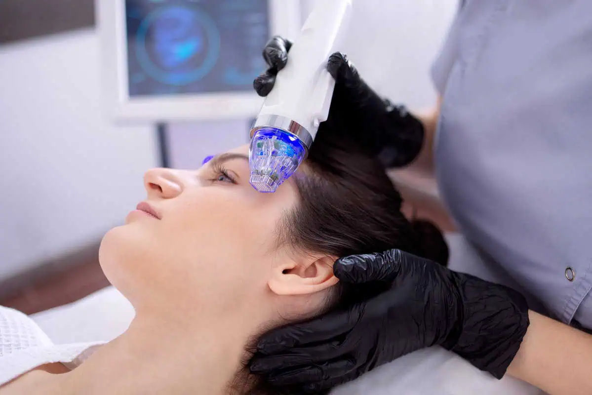 CO2 laser and RF microneedling treatment